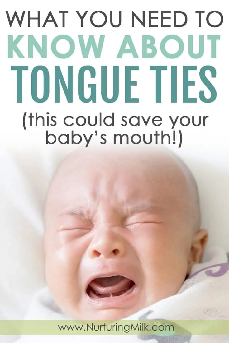 Everything You Need to Know About Tongue Ties - Nurturing Milk