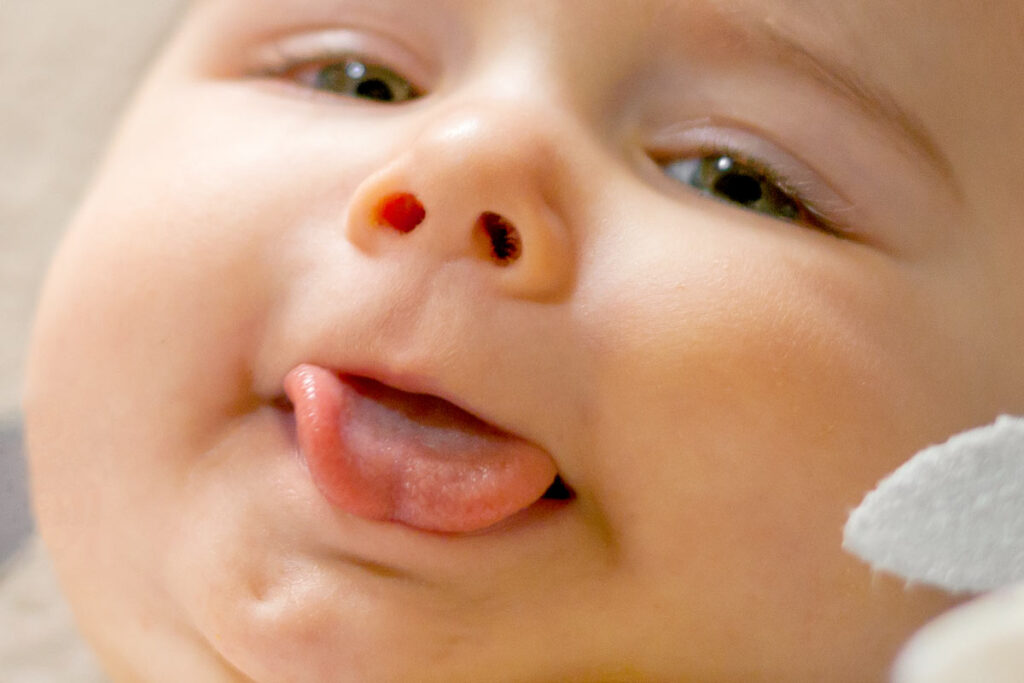 A heart shaped tongue is often a sign of a tie but doesn't necessarily mean baby will have issues.